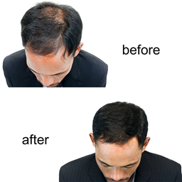 Zeige Details für Hairline - Microblading Ausbildung Bild von Hairline - Microblading Ausbildung